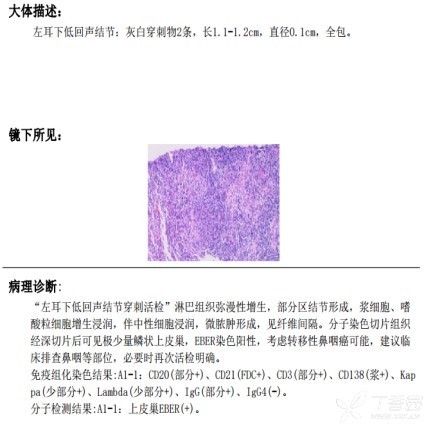 供卵试管婴儿移植后1-10天的感觉