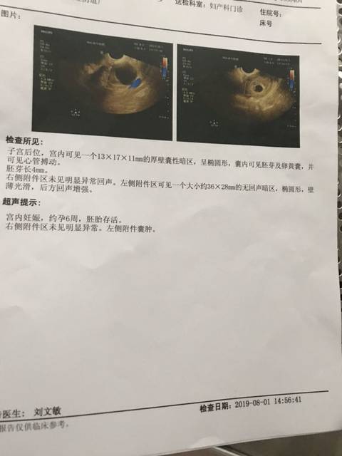 卵泡发育不良如何通过第三代供卵试管婴儿成功怀孕
