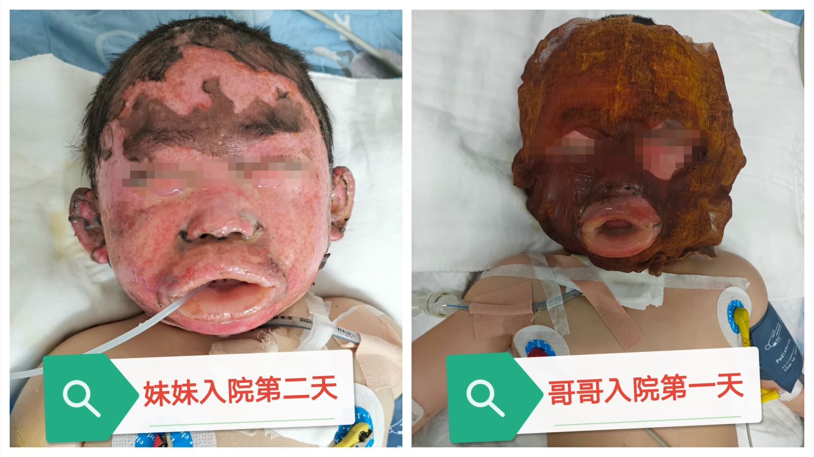 4年缓慢的供卵试管婴儿之旅，在江苏南京市妇幼保健院仍以失败告终