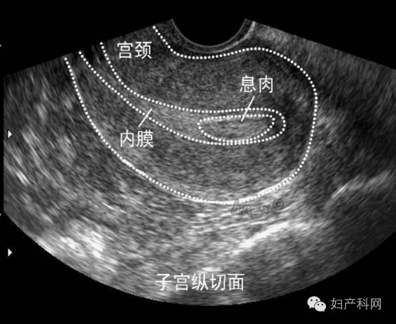 47岁林志玲突然得子被质疑是做供卵试管婴儿，其实她怀孕早有迹象