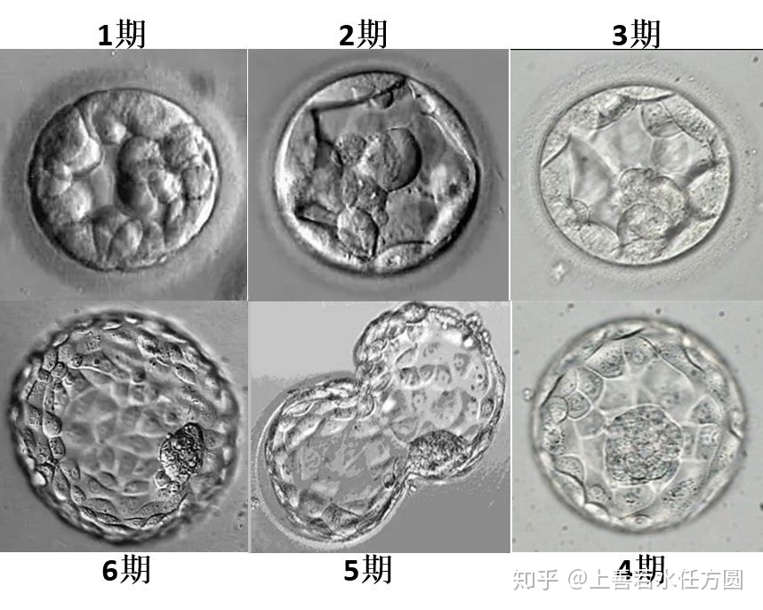 做借卵助孕代生试管在医院可以报销吗？