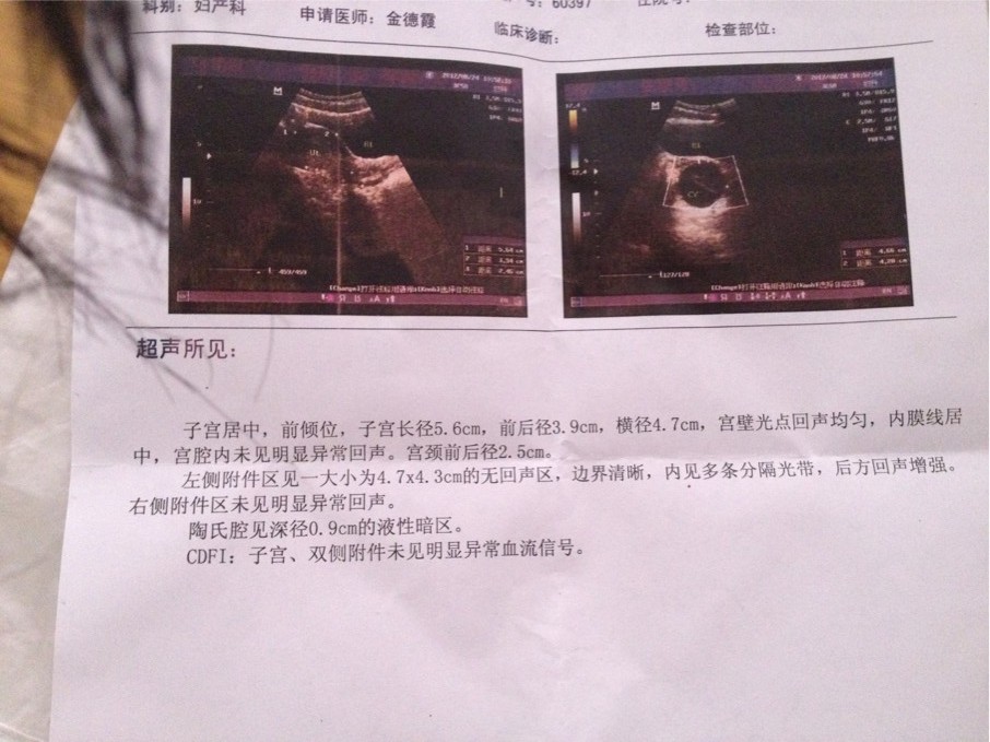 女性供精试管代生代怀的5个副作用，发胖、变丑......都可能发生