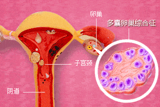 未婚女性能不能做供卵试管婴儿