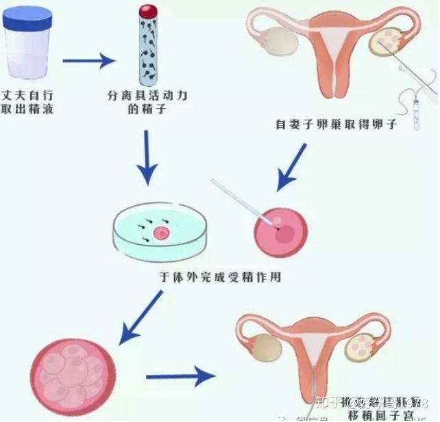 未婚女性能不能做供卵试管婴儿