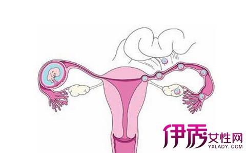 南京试管代妈公司