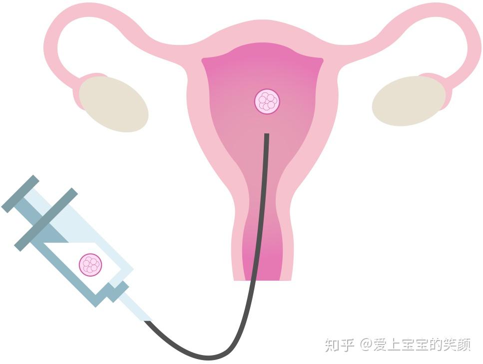 试管婴儿要做什么检查你造吗