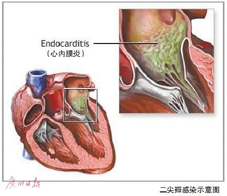找代怀机构二代怎样取精