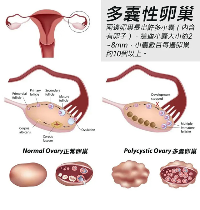 卵巢退化怎么办啊以后多注意什么