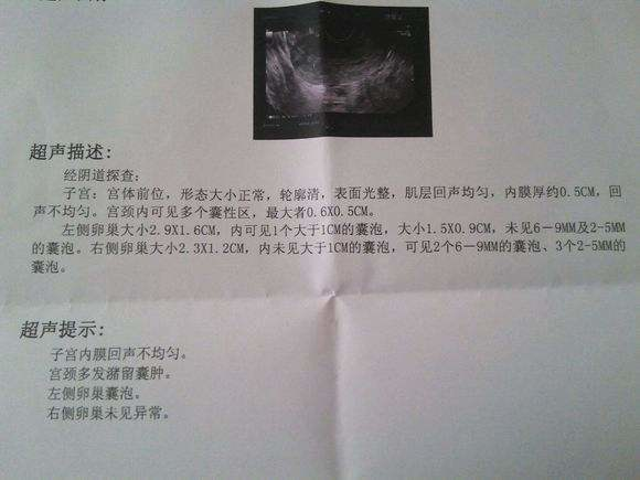 南京内分泌失调能做代怀公司多吗吗