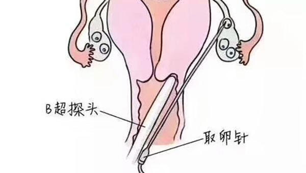 南京哪个医院代生供卵代怀
