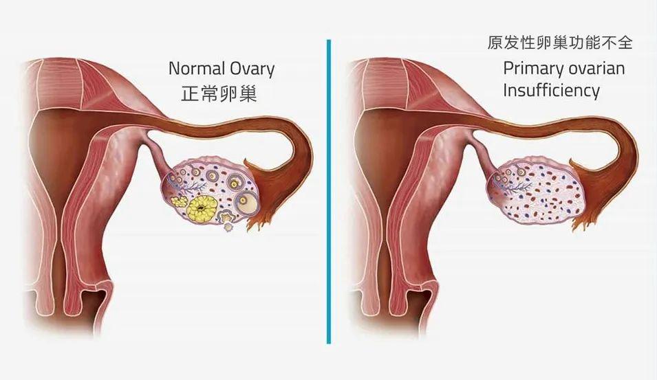 如何合法试管代怀婴儿吃哪种蛋白粉好南京试管龙凤胎价格表