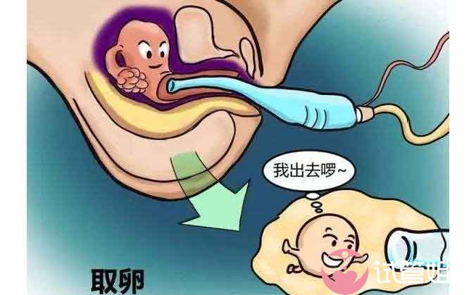 南京率先“音乐试管公立不用等”诞生,试管胚胎期间就开始接受音乐