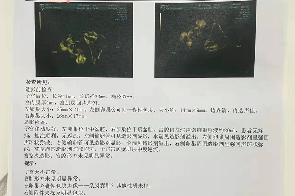 2024南京大学附属第一医院三代试管生龙凤胎费用清单一览,附成功率分析