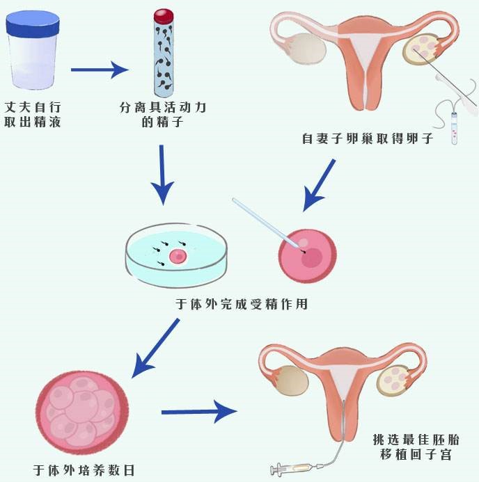 试管三代私立医院一针长效降调
