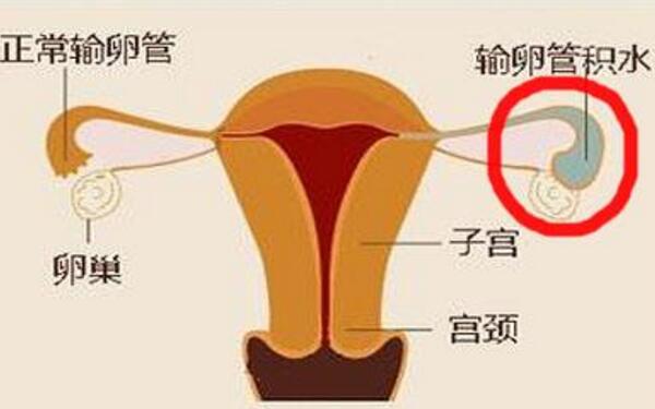 艾滋病可以在那家医院供卵生子哪里可以做婴儿吗