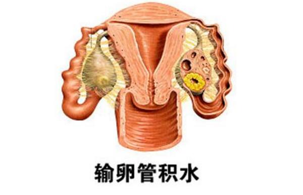 三代试管助孕公司机构取卵代怀孩子价格怎么取卵_代怀做男孩多少钱疼吗